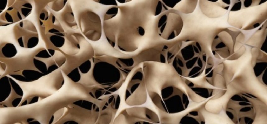 osteoporosis single image